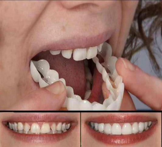 Sérénident - Flexible anpassbare Prothese